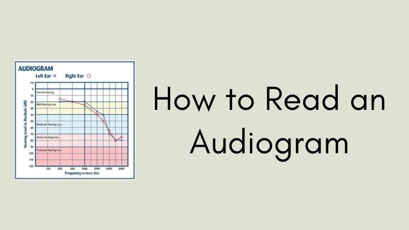 How to Read an Audiogram
